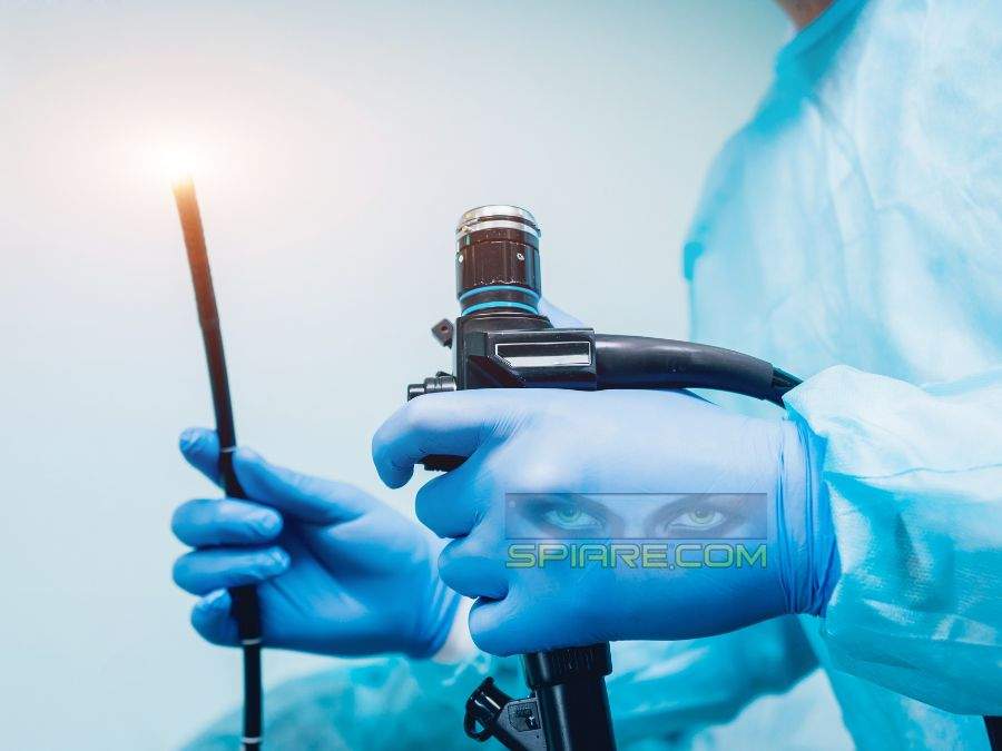 a-cosa-serve-la-telecamera-endoscopica